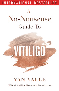 A No-Nonsense Guide to Vitiligo