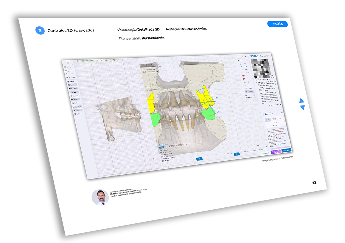 Ebook iortho angel aligner