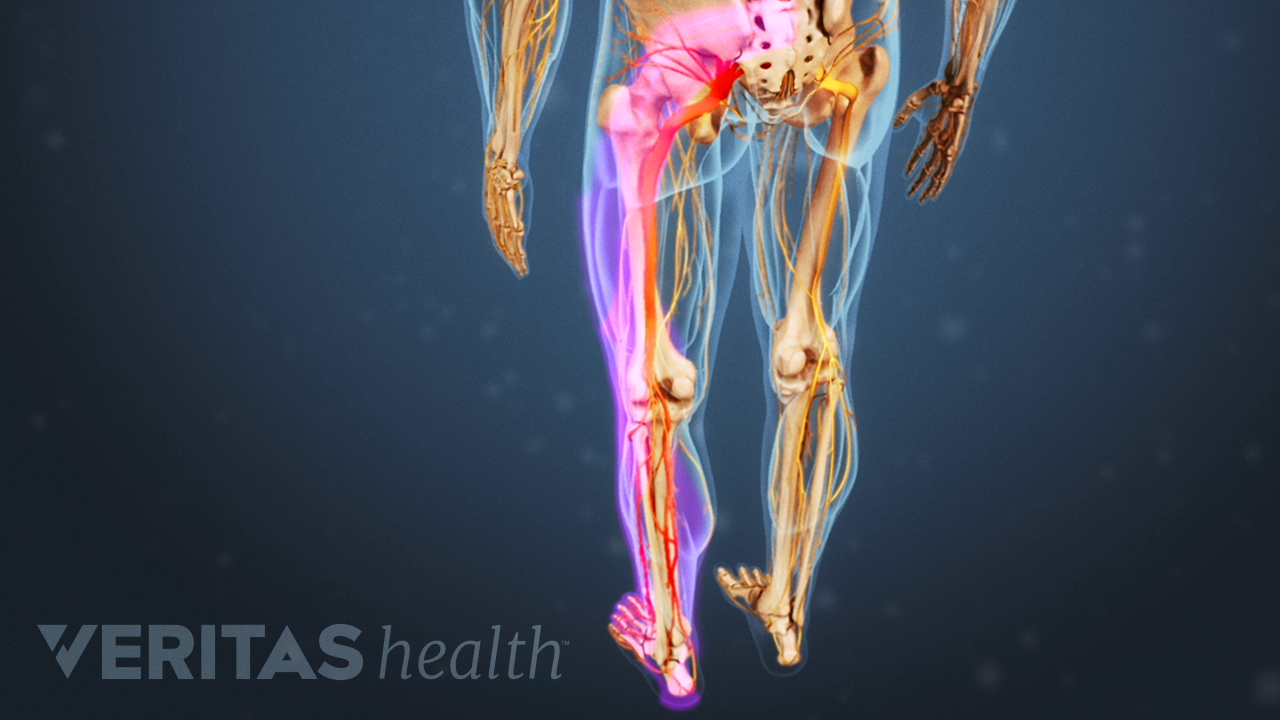 3D rendering of the sciatic nerve
