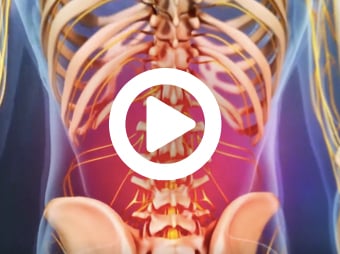 Video still with 3D rendering of lower back