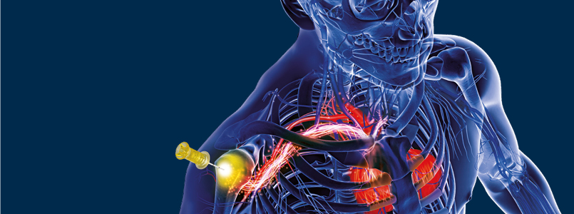 The EZ-IO workshop The EZ-IO workshop