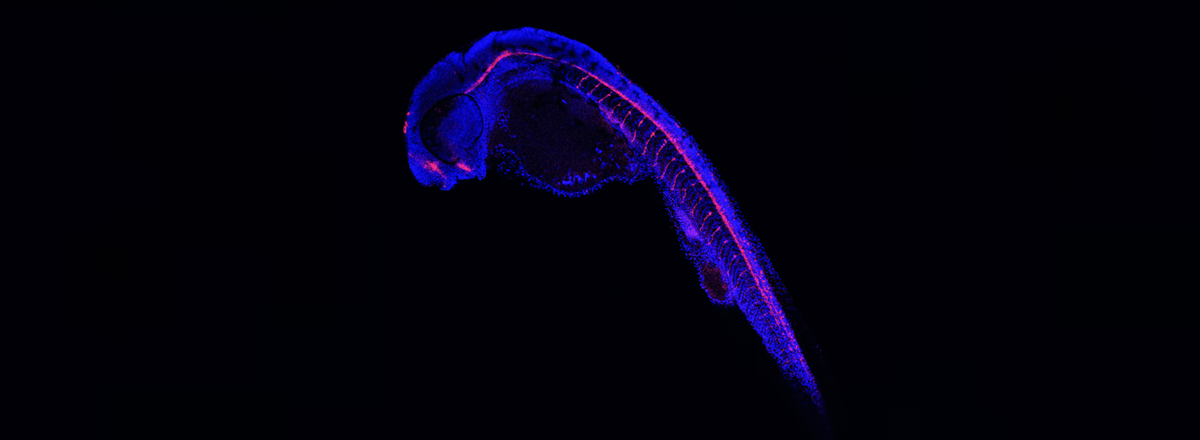 Possible therapeutic targets identified for ALS and frontotemporal dementia