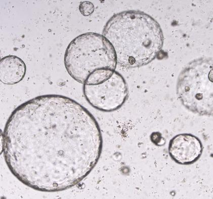 Human colorectal cancer organoids