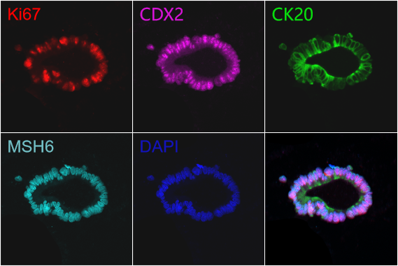 Organoid validation markers