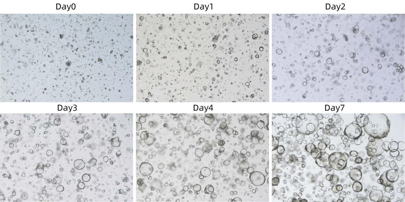 Mouse lung organoids