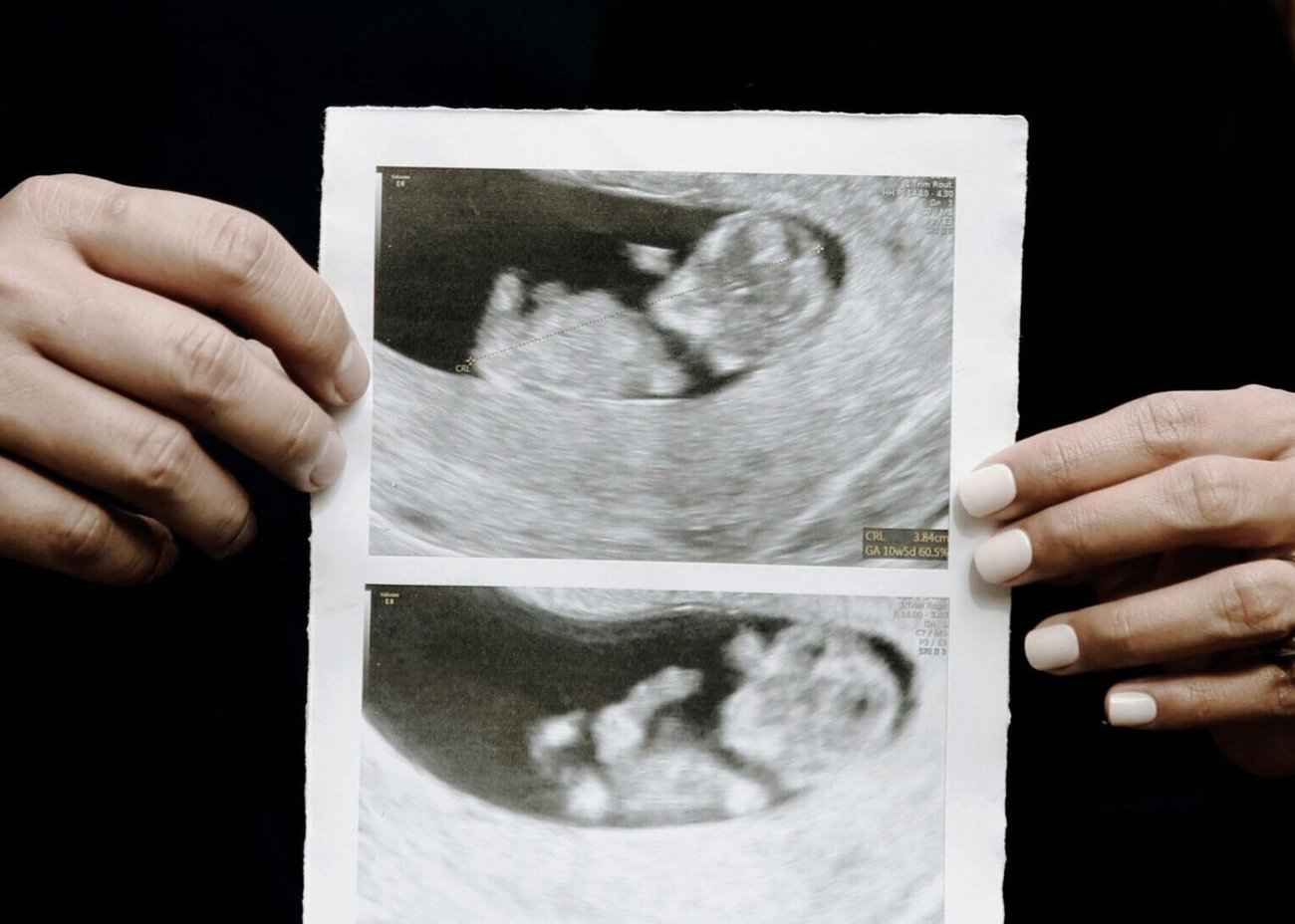 Ultrasound.jpg Ultrasound.jpg