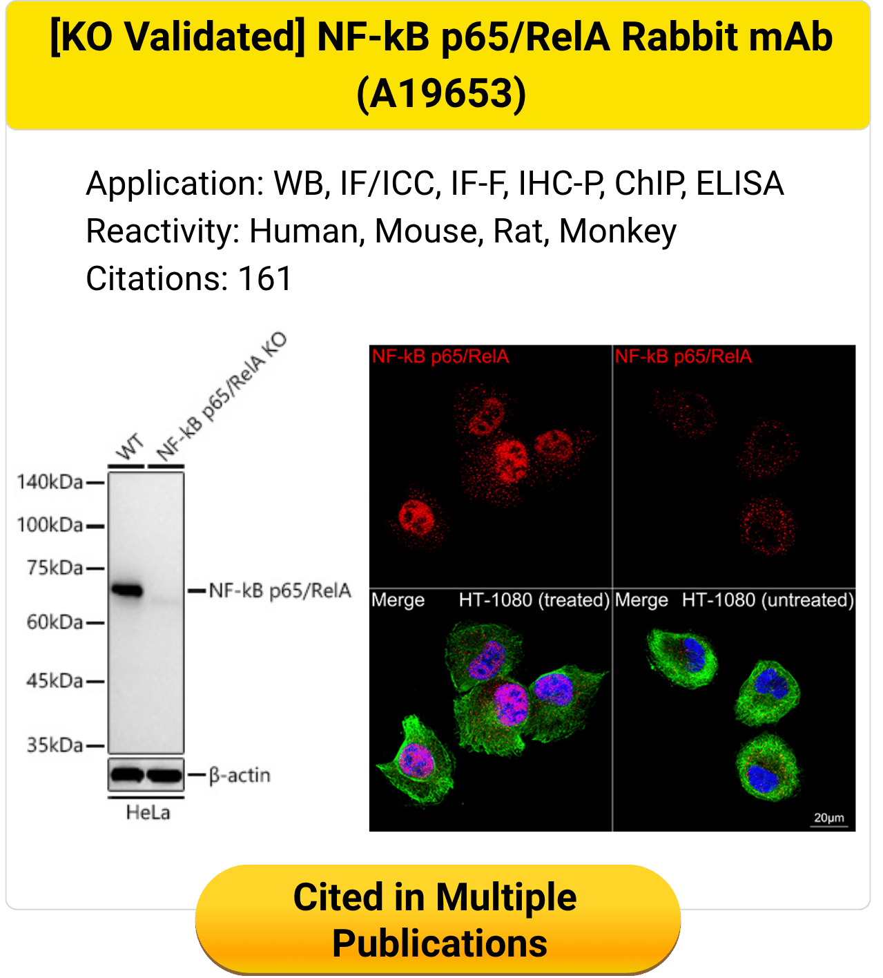 Knockout validated NF-kB p65 RelA Rabbit monoclonal antibody A19653