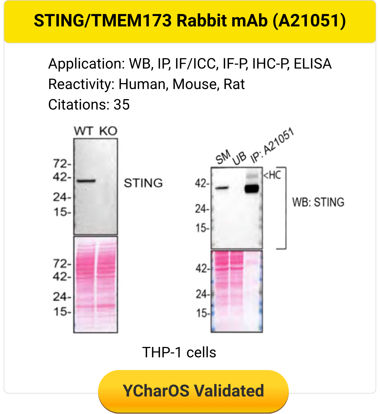 STING TMEM173 Rabbit monoclonal antibody A21051