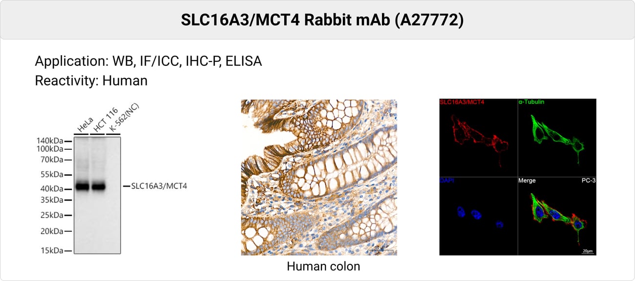 MCT1 and MCT4 antibodies for lactate transport research
