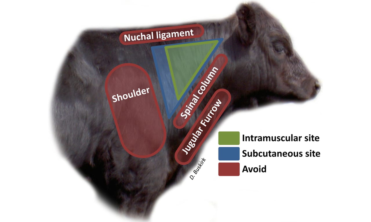 Photo showing the trapezoidal muscle for proper injection site