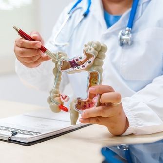 A doctor holding a model of a human colon