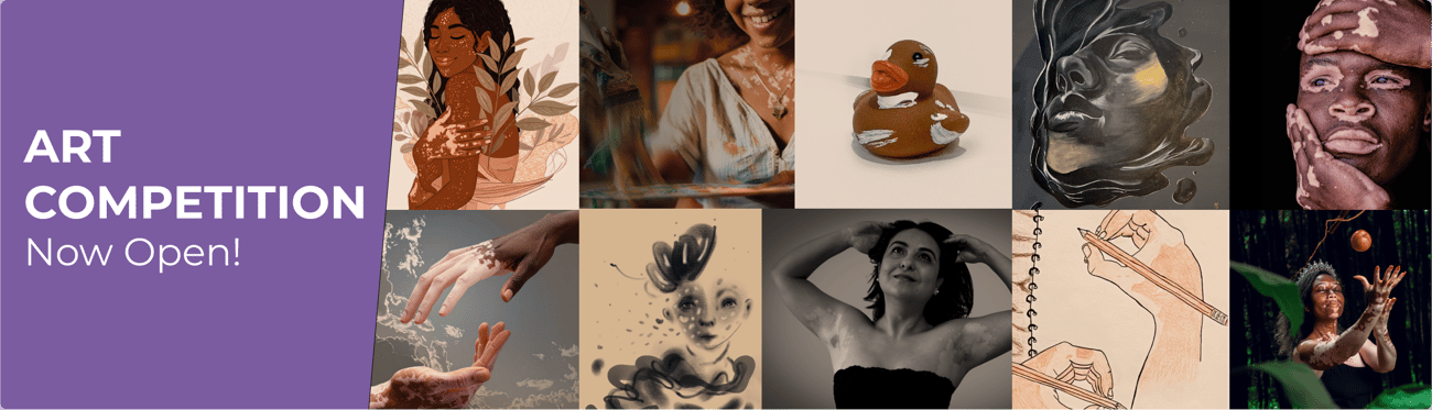 World Vitiligo Day 2025 - REGISTER NOW