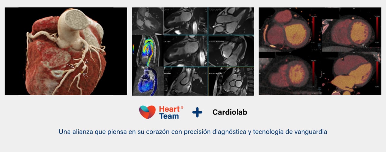 Cáncer cervicouterino