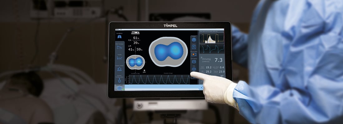 Electrical impedance tomography (EIT) in mechanical ventilation