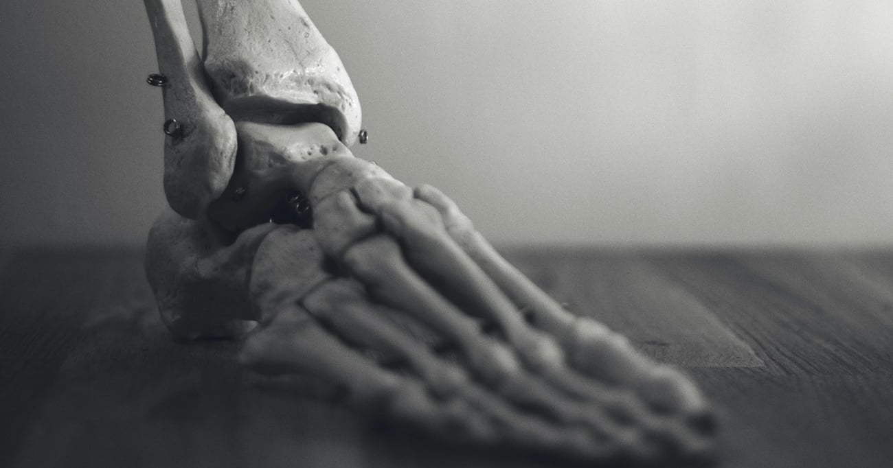 PRP for ankle osteoarthritis?